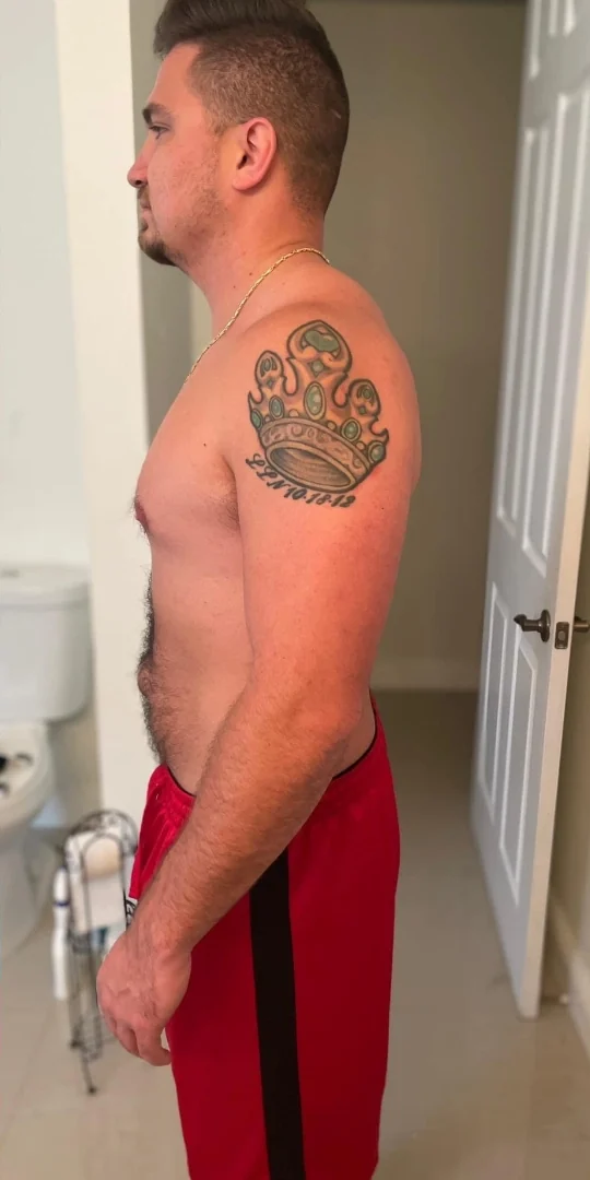 Same client after weight loss