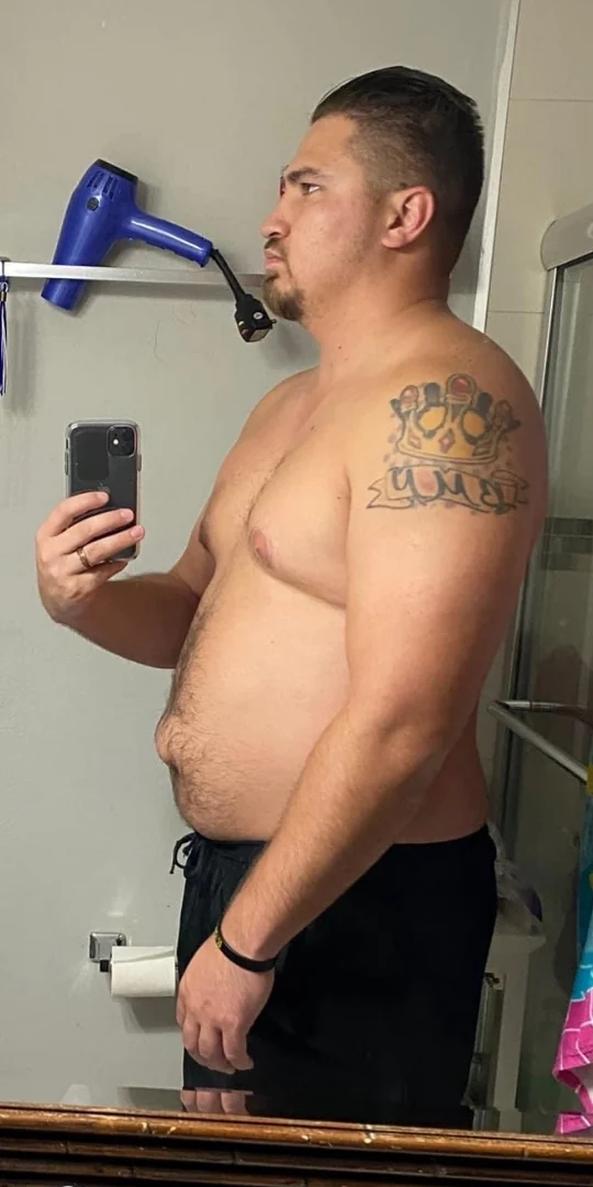 Client before, weight loss transformation
