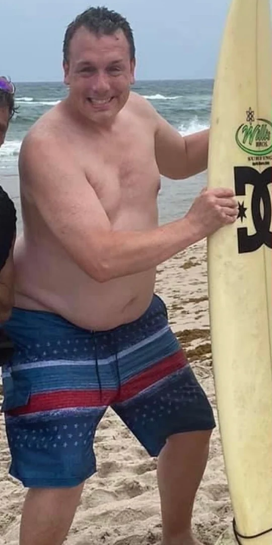 Client before, weight loss