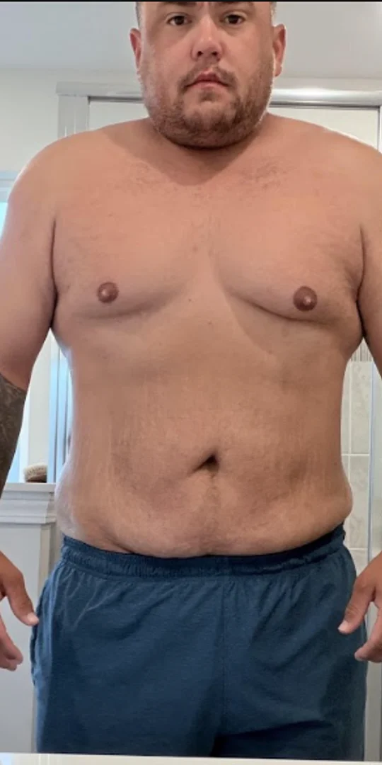 Same client after weight loss
