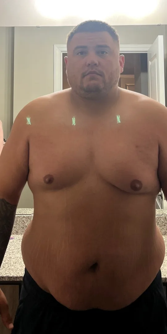 Client before, weight loss
